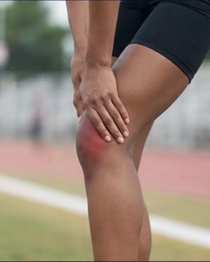 Person experiencing symptoms related to Iliotibial band-related lateral knee pain