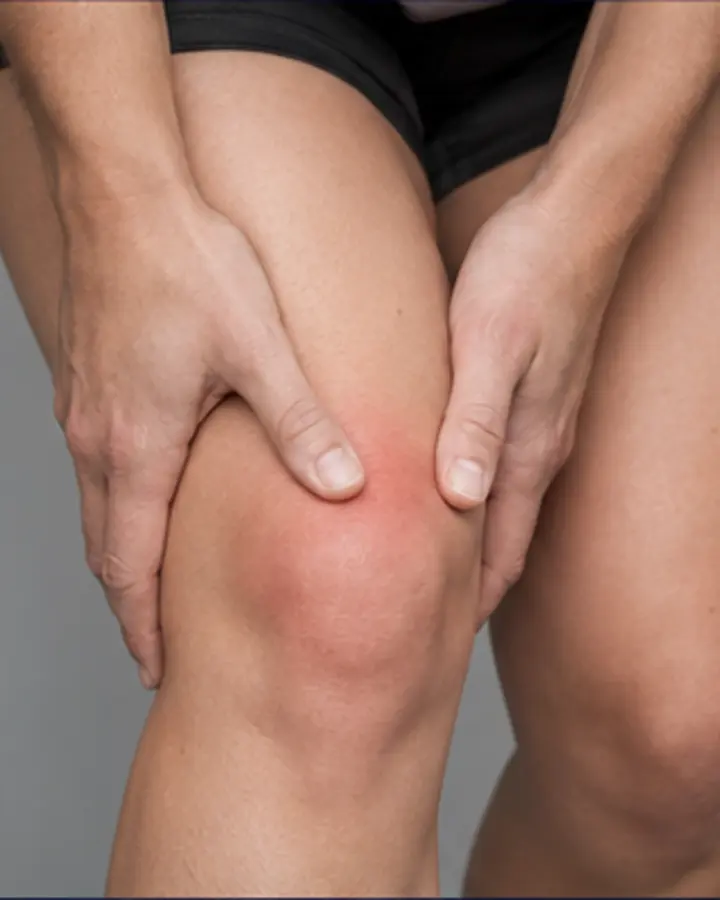 Person experiencing symptoms related to Patellofemoral pain